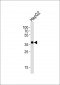 OR2M7 Antibody (C-term)